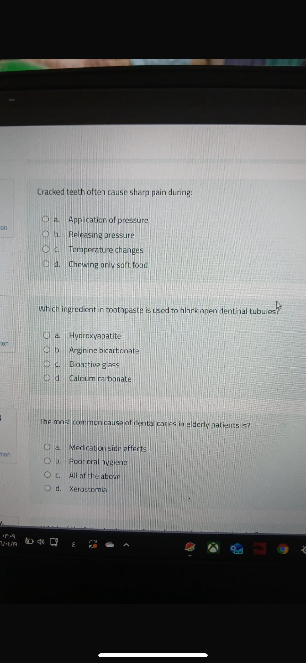 Cracked teeth often cause sharp pain duringa.
