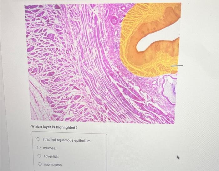 stratified squamous epithelium layers