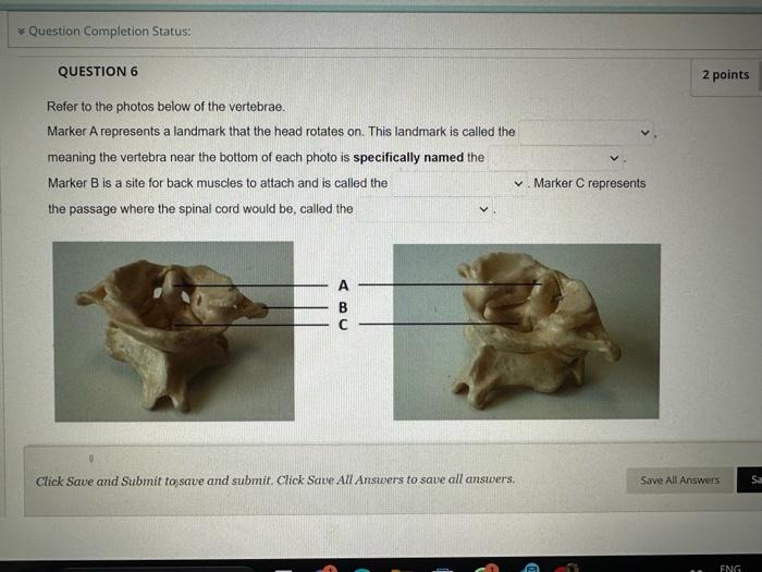 Solved Refer to the photos below of the vertebrae. Marker A | Chegg.com