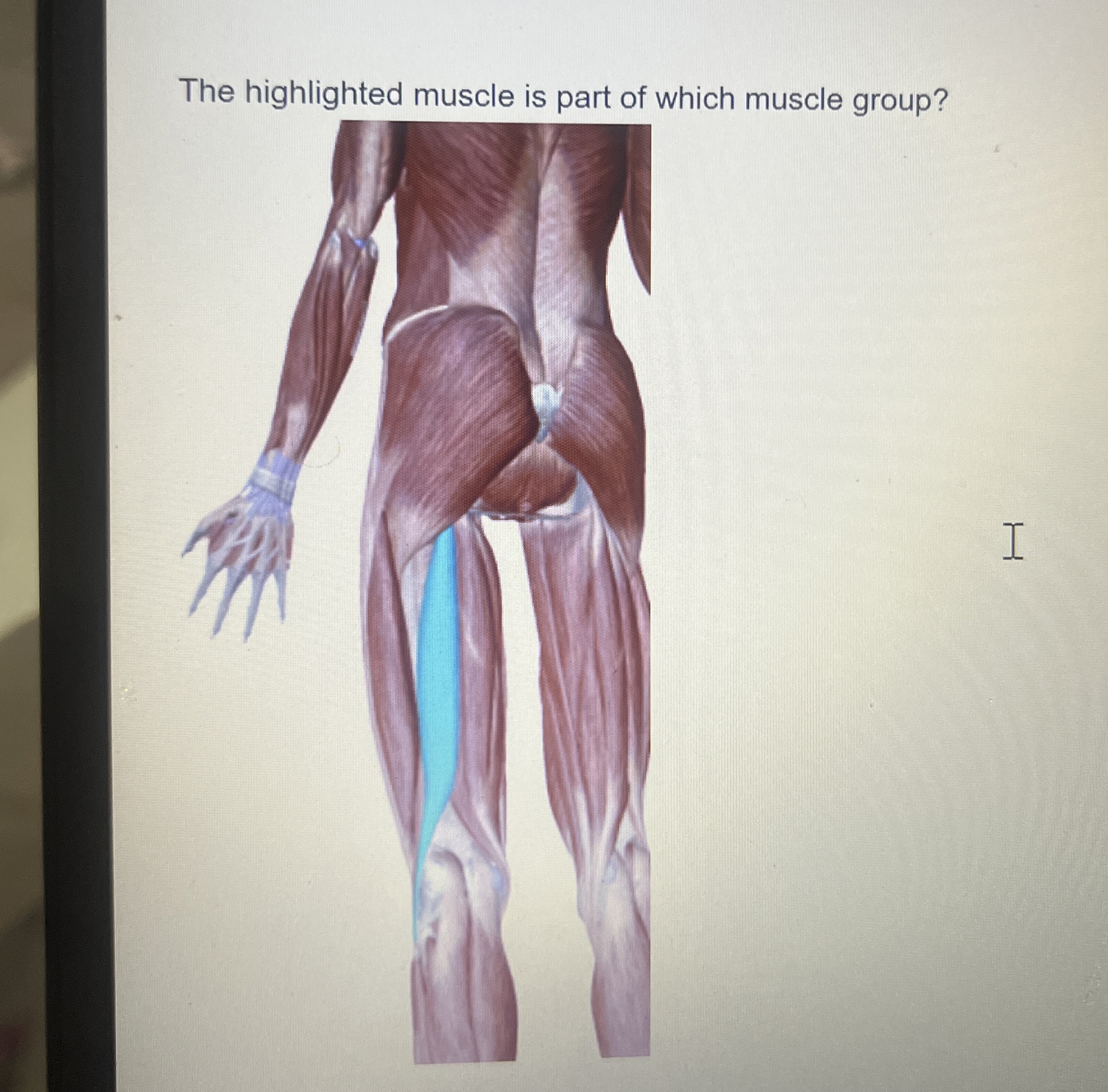 Solved The highlighted muscle is part of which muscle group? | Chegg.com
