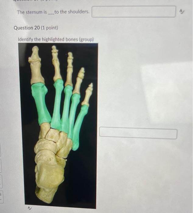 Solved Question 15 (1 point) Identify the highlighted | Chegg.com