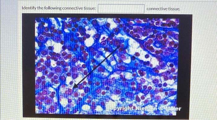 Solved Identify the following connective tissue: connective | Chegg.com ...