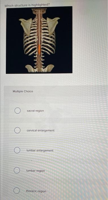 Solved Which structure is highlighted? Multiple Choice | Chegg.com