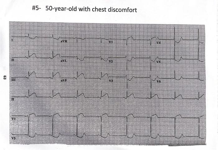 #5- 50-year-old with chest discomfort