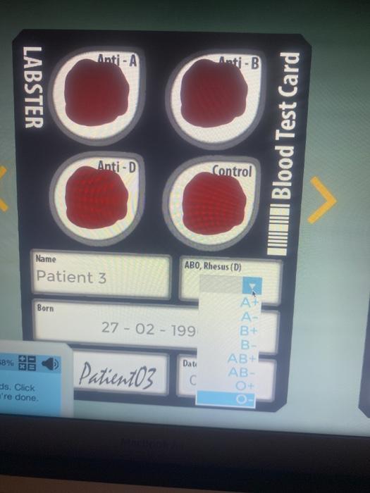 Solved Anti-A Anti-B LABSTER TONI Blood Test Card Anti-D | Chegg.com