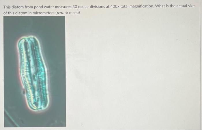 Solved This diatom from pond water measures 30 ocular | Chegg.com