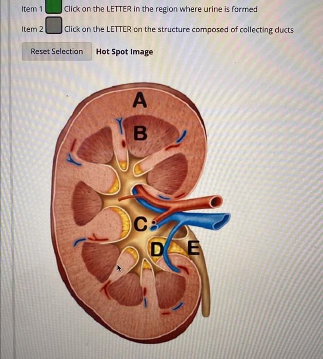 Solved Item 1 Click on the LETTER in the region where urine | Chegg.com