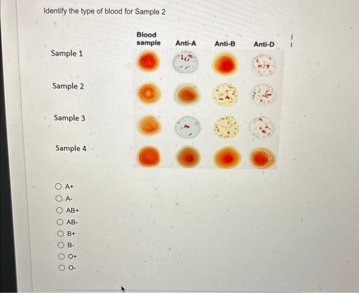 Solved Identify the type of blood for Sample 2 A+ A- AB+ | Chegg.com