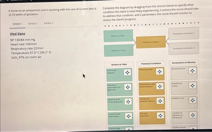 solved-a-nurse-on-an-antepartum-unit-is-assisting-with-the-chegg