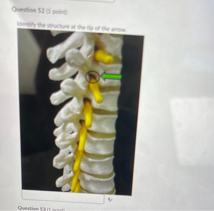 Solved Identify the body region at the tip of the | Chegg.com