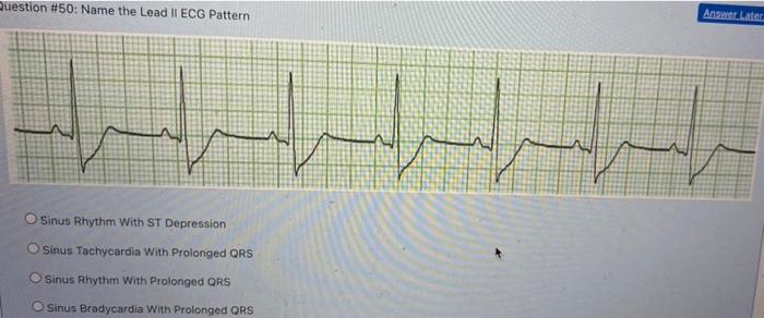 Solved Question #40: Identify the Lead II ECG pattern. | Chegg.com