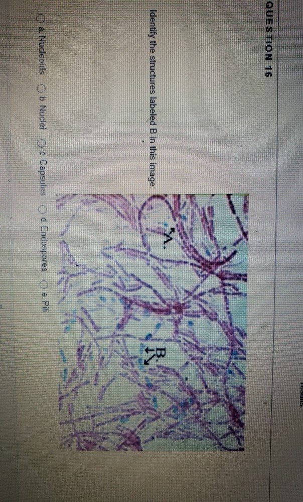 Solved ICUS QUESTION 16 Identify the structures labeled B in | Chegg.com