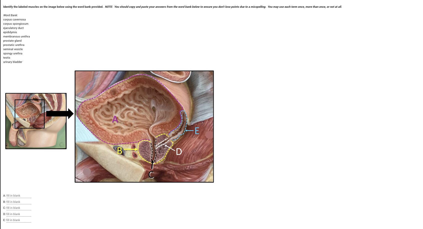 Solved Word Bank corpus Cavernosa corpus Spongiosum Chegg Solved word bank corpus cavernosa corpus spongiosum chegg