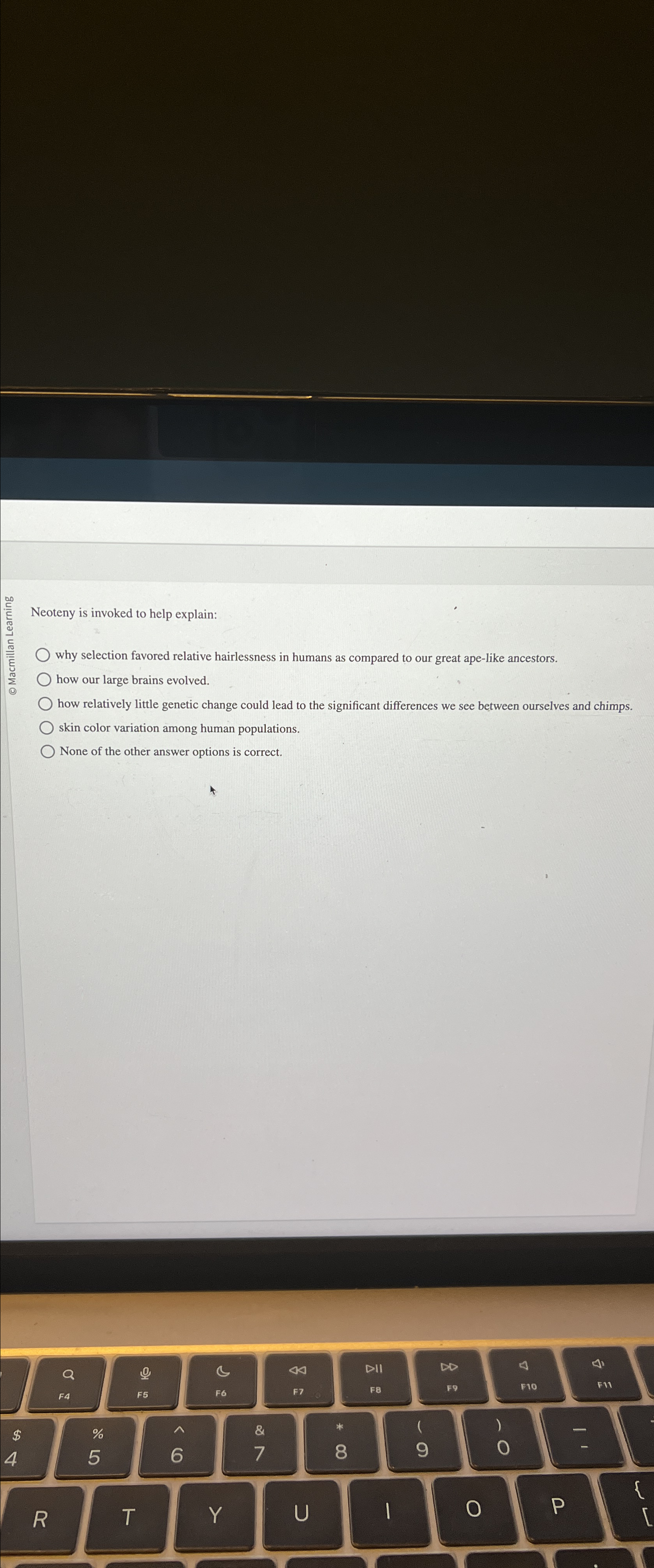 Solved Neoteny is invoked to help explain:why selection | Chegg.com