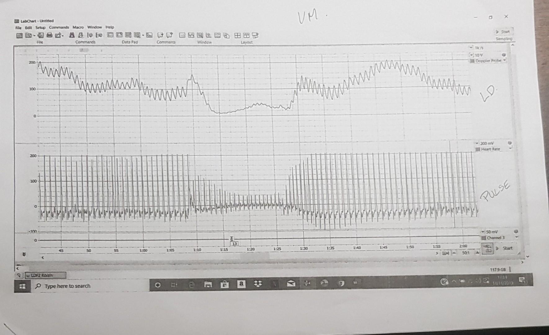 Measurement of skin blood flow by laser Doppler | Chegg.com