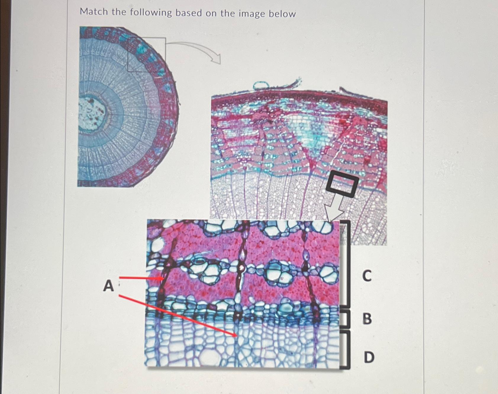 Solved Match the following based on the image below | Chegg.com