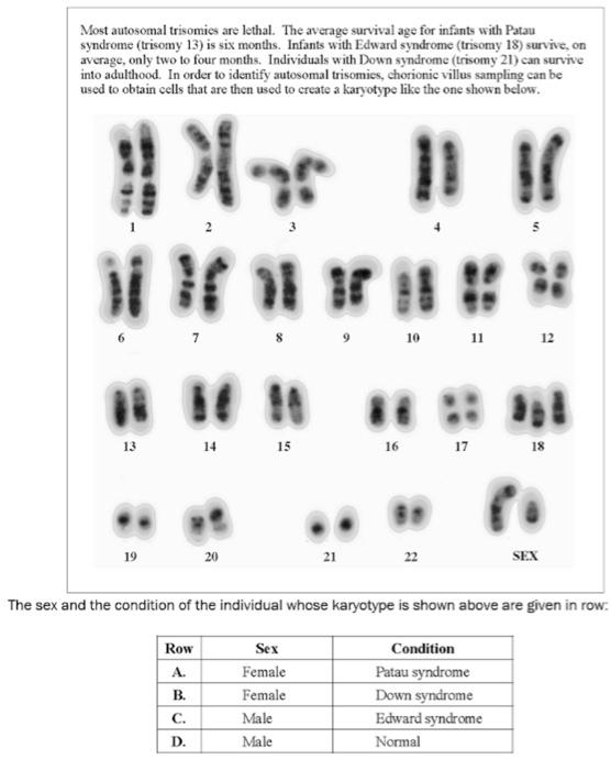 edward syndrome chromosomes