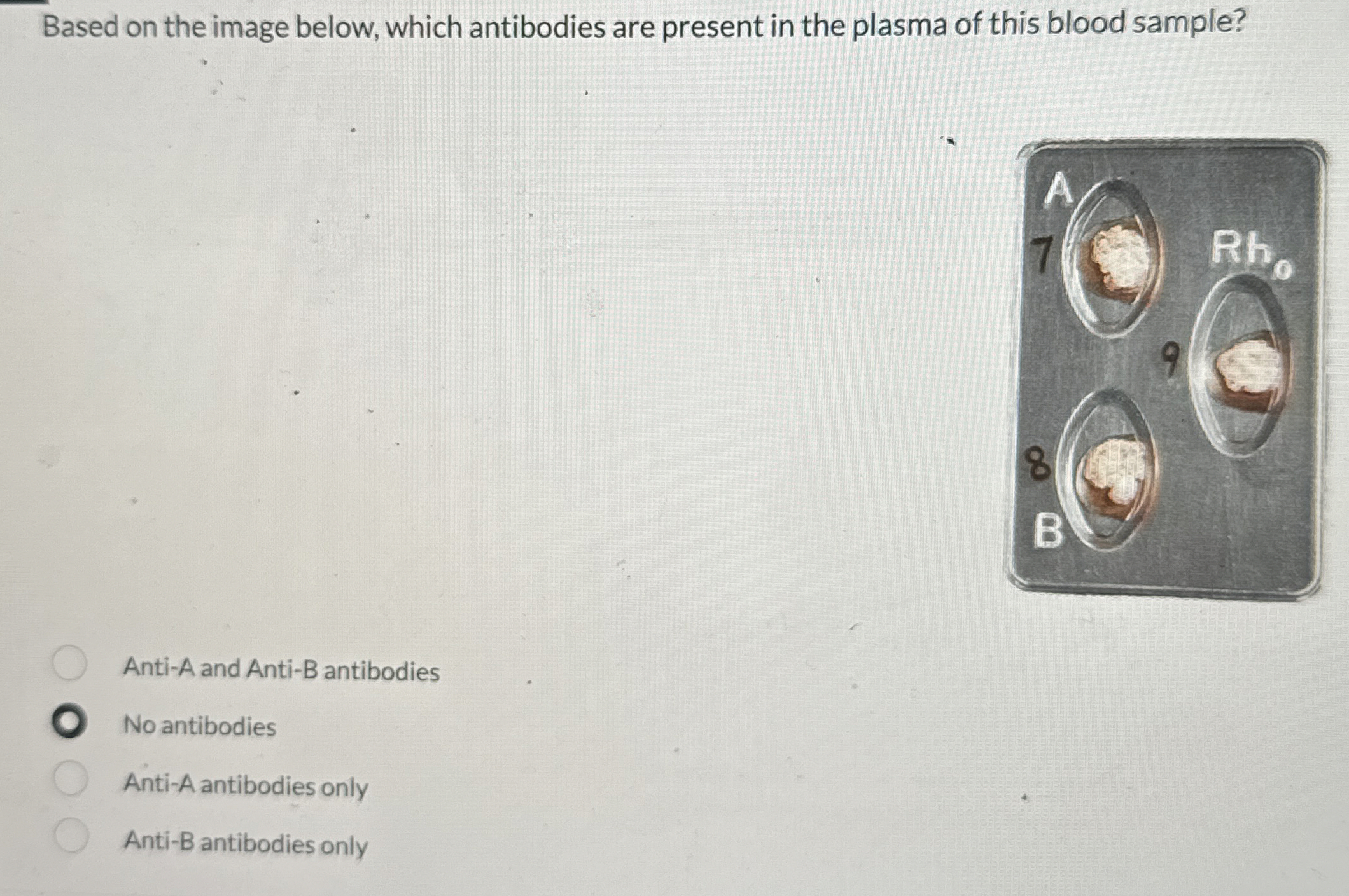 Solved Based on the image below, which antibodies are