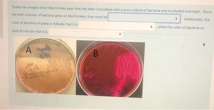 Solved You perform the Gram stain your Unknown in Exercise | Chegg.com