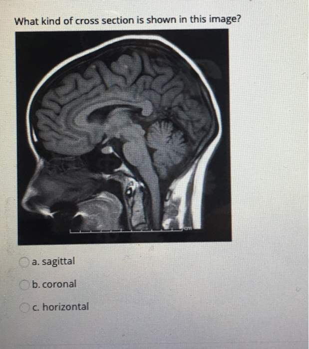 Solved What kind of cross section is shown in this image? a. | Chegg.com