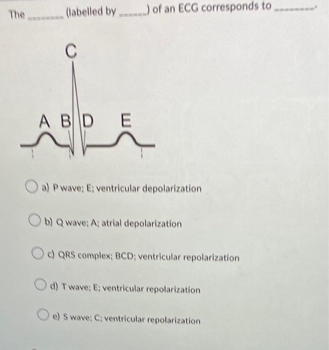 Solved The (labelled by) of an ECG corresponds to C A B D E | Chegg.com