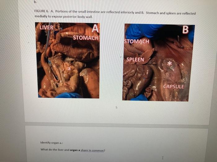 b. FIGURE 6. A. Portions of the small intestine are reflected inferiorly and B. Stomach and spleen are reflected medially to