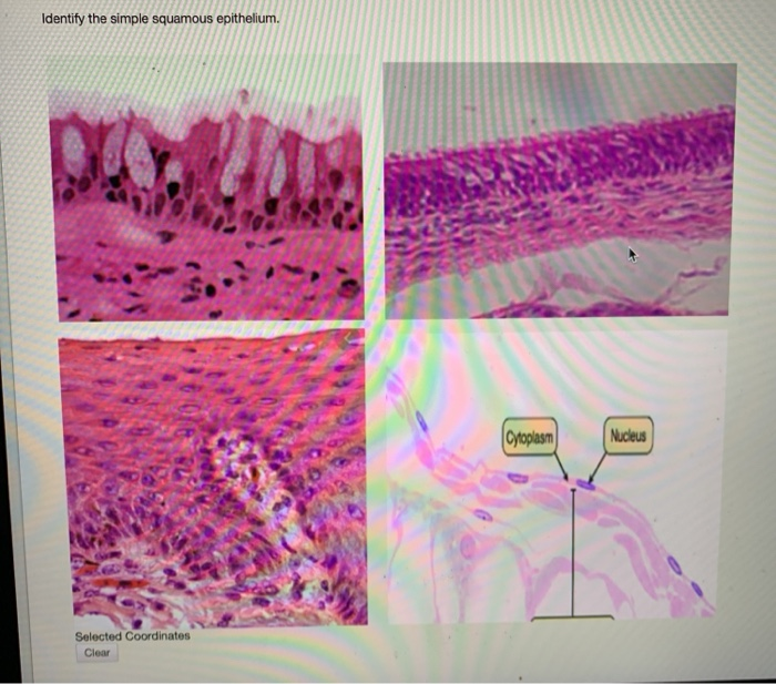 Solved Identify The Simple Squamous Epithelium Cytoplasm