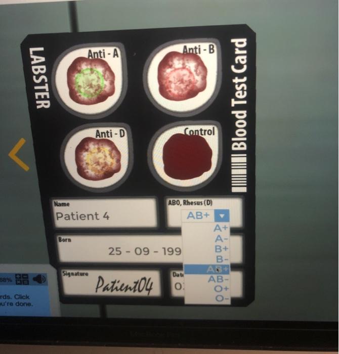 Solved Anti-A Anti-B LABSTER ||||| Blood Test Card Anti-D | Chegg.com