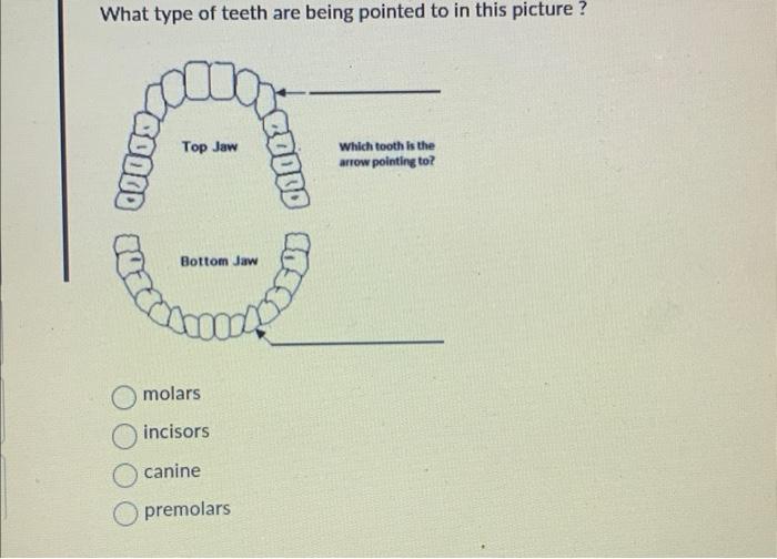Solved What type of teeth are being pointed to in this | Chegg.com