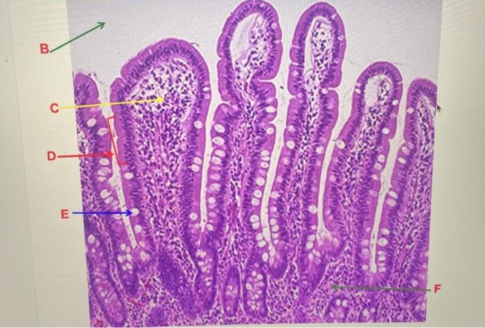 Solved A) Looking At The Entire Photomicrograph, What Is The 