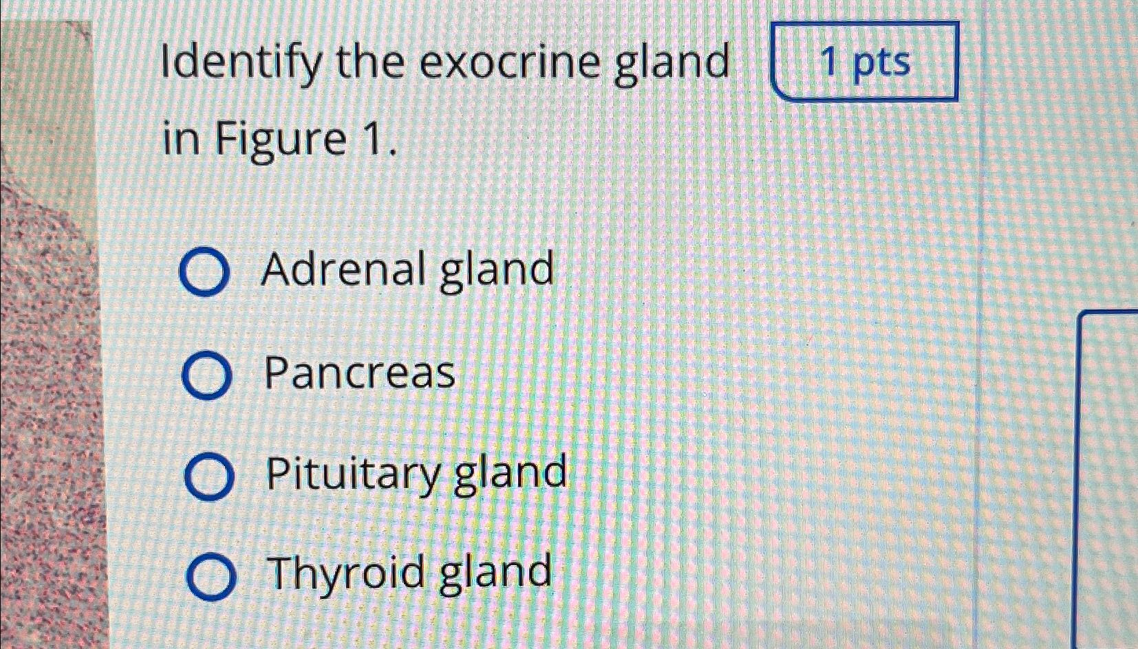 Solved Identify the exocrine gland in Figure 1.Adrenal