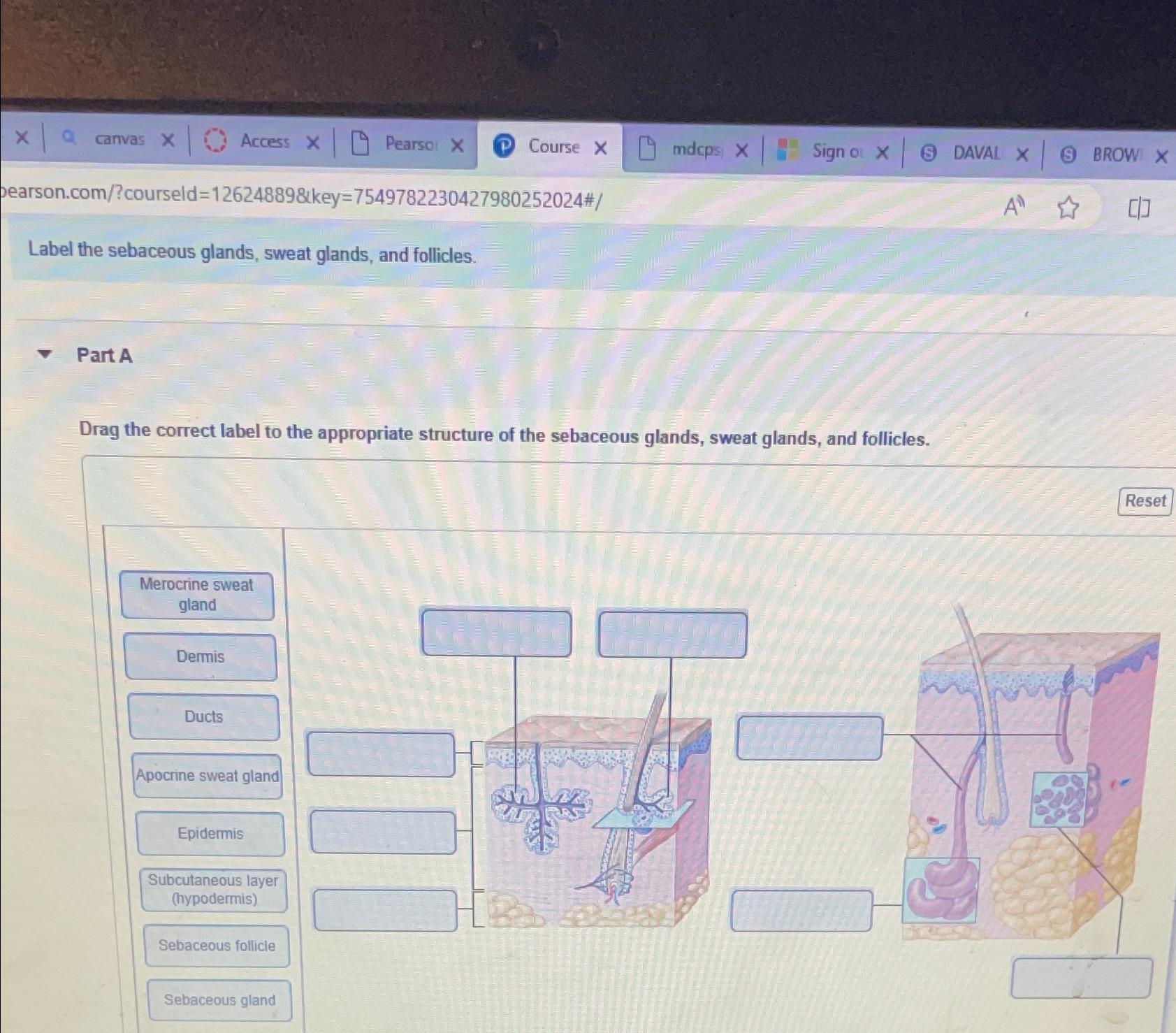 Solved Label The Sebaceous Glands, Sweat Glands, And 