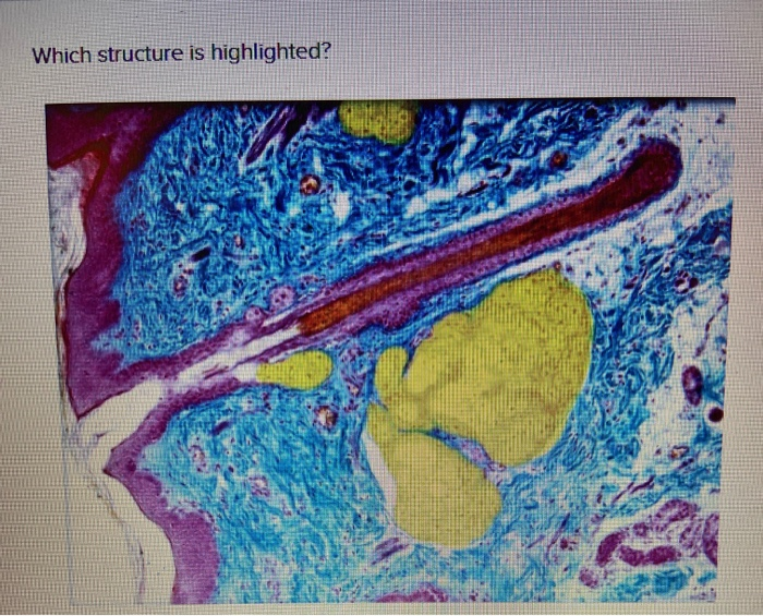 solved-which-structure-is-highlighted-multiple-choice-chegg