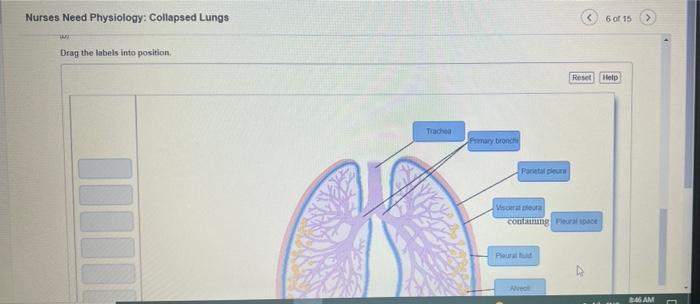 Solved Nurses Need Physiology: Collapsed Lungs Drag the | Chegg.com