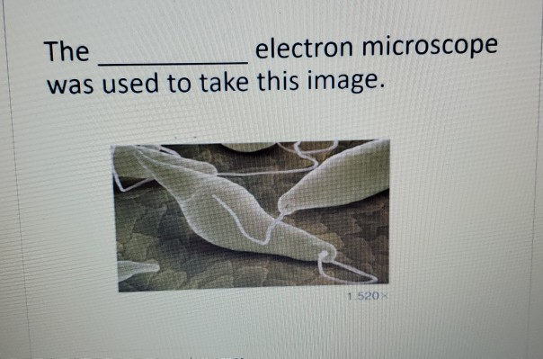 Solved The electron microscope was used to take this image. | Chegg.com