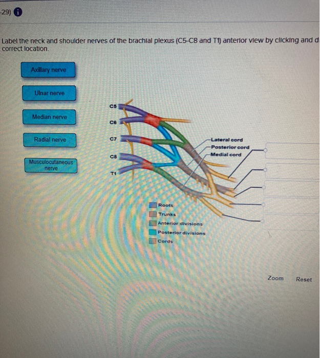 Solved 29 Label The Neck And Shoulder Nerves Of The