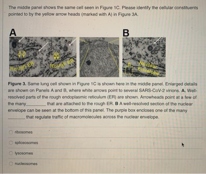 Solved The middle panel shows the same cell seen in Figure | Chegg.com