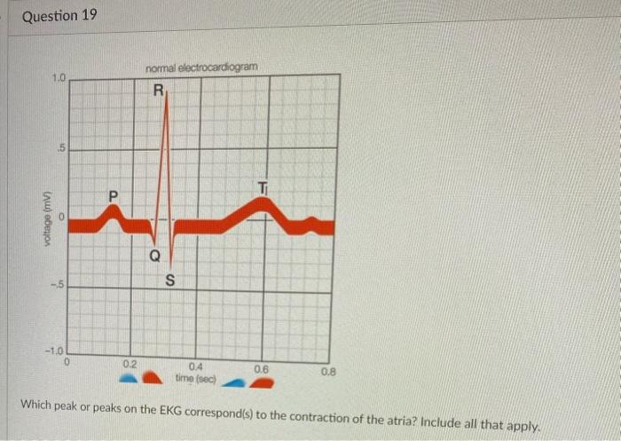 Solved Which peak or peaks on the EKG correspond(s) to the | Chegg.com