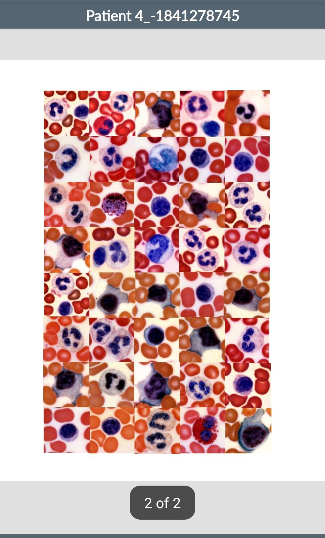 Solved Differential White Blood Cell Count You will be | Chegg.com