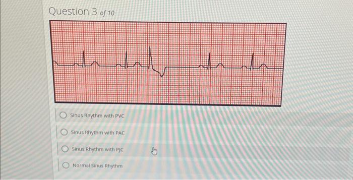 icd 10 code for sinus rhythm with pvcs