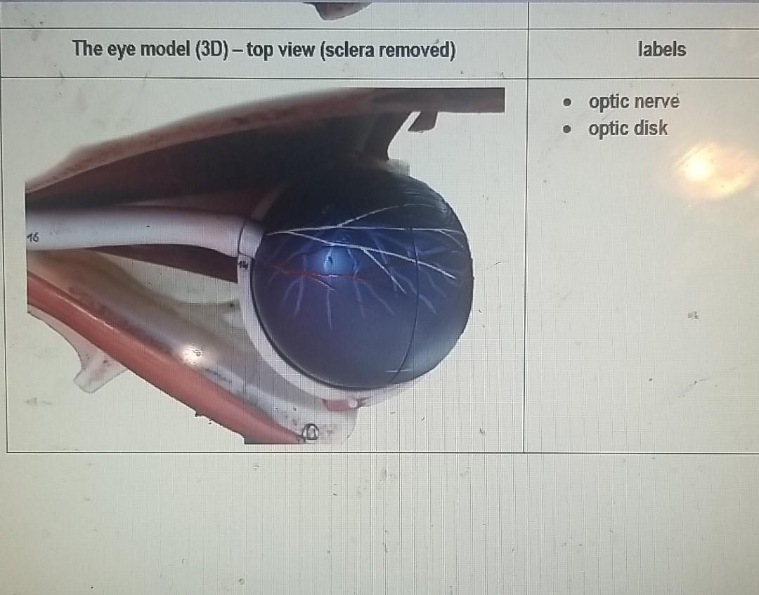 eye model labeled lacrimal gland