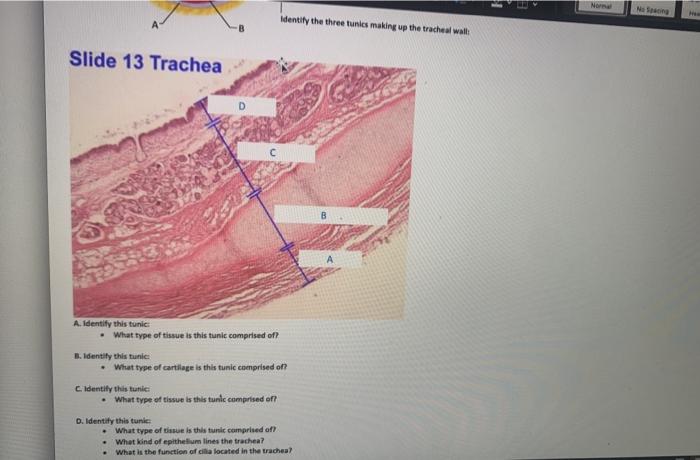 trachea slide labeled