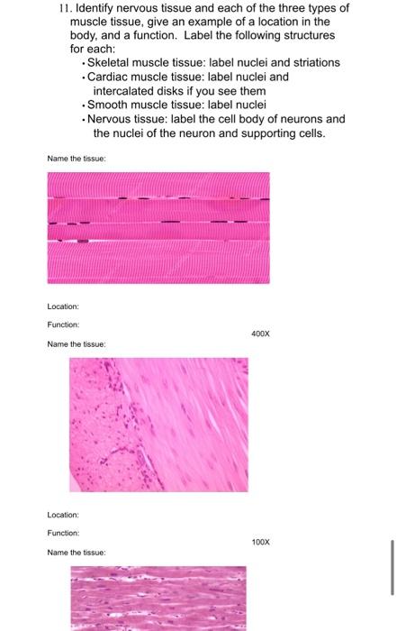 11. Identify nervous tissue and each of the three types of muscle tissue, give an example of a location in the body, and a fu