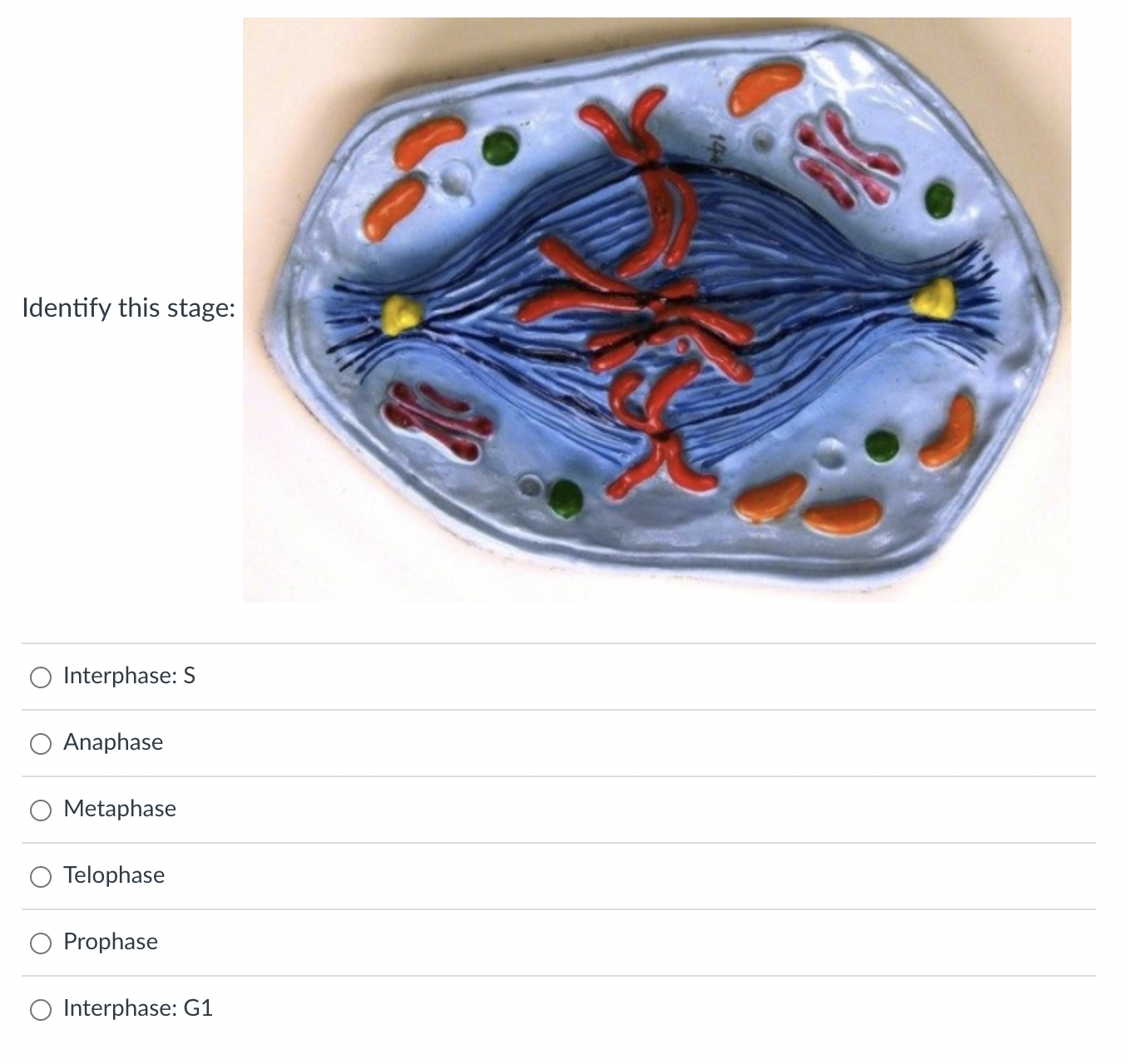 Solved Identify this stage:Interphase: | Chegg.com
