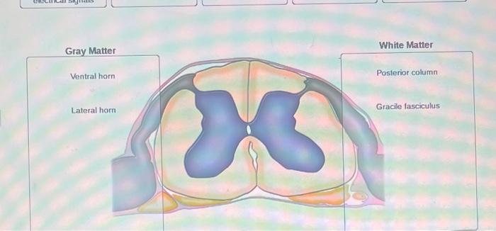Solved Gray and White Matter of the Spinal Cord Each label | Chegg.com