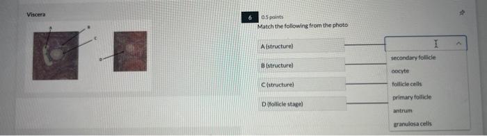 Solved Viscera Q 05 points Match the following from the | Chegg.com
