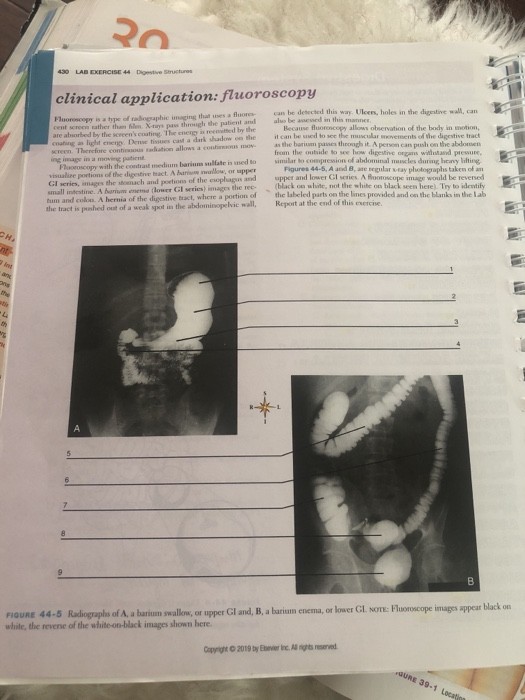 Solved 430 LAB EXERCISE 44 Digestive Structures clinical