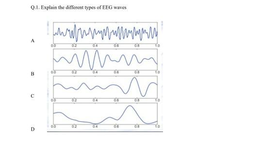 Solved Q.1. Explain the different types of EEG waves M A 00 | Chegg.com