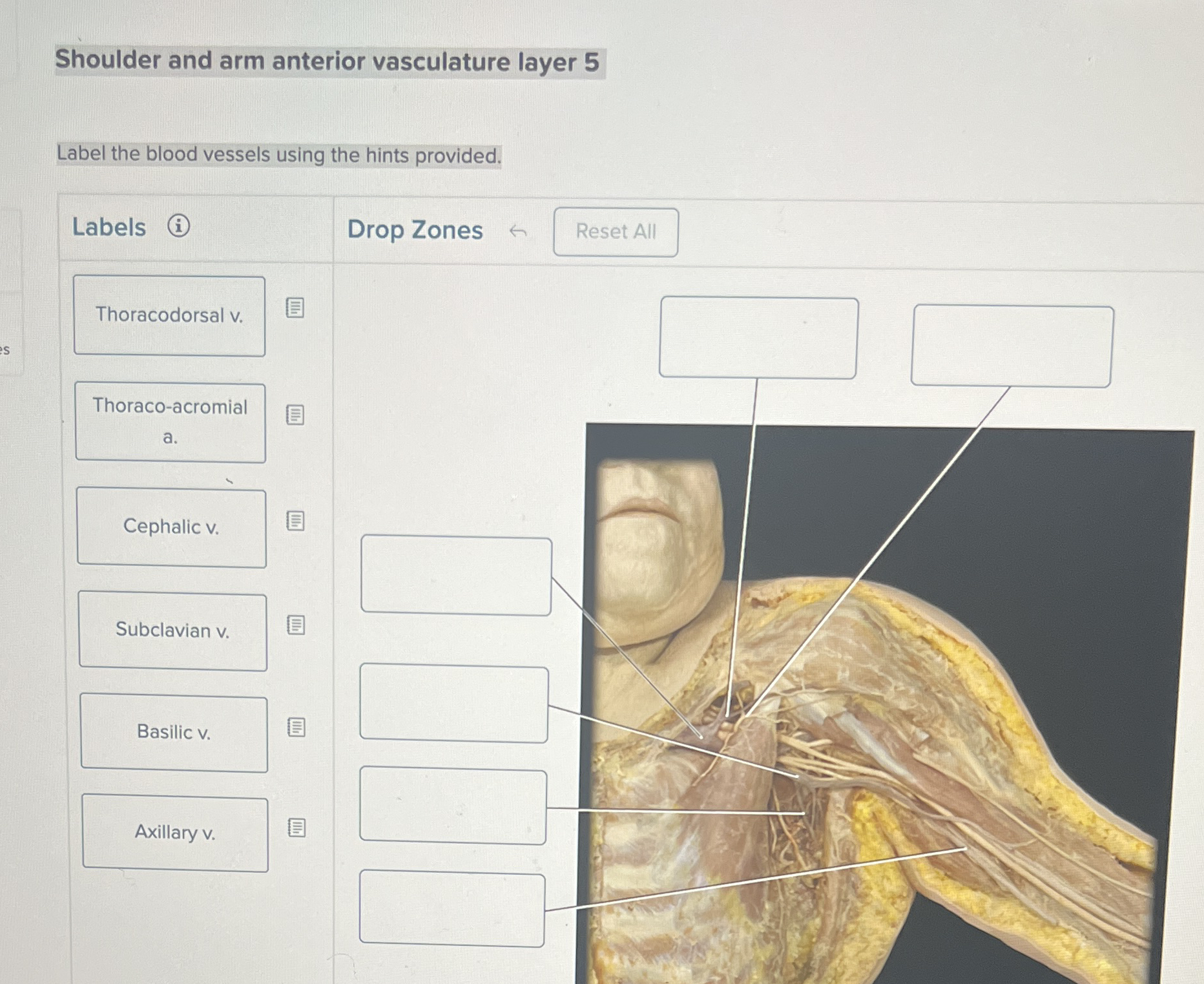 Shoulder and arm anterior vasculature layer 5Label | Chegg.com