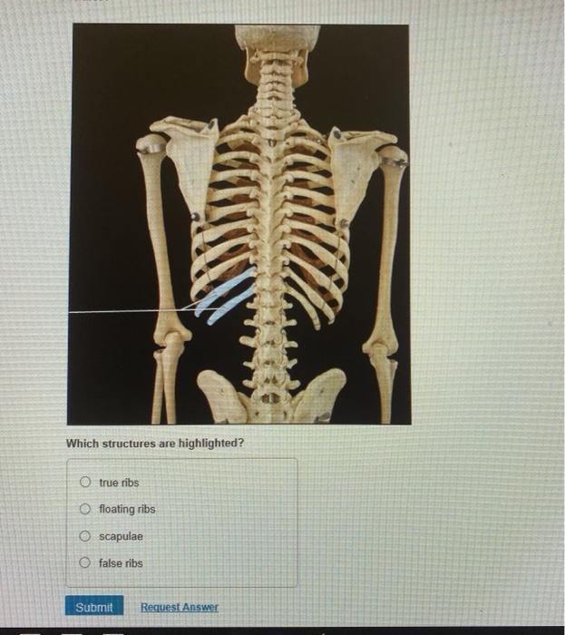 Question: V Part A > Which Structures Are Highlighted? O Thoracic” title=”Question: V Part A > Which Structures Are Highlighted? O Thoracic” width=”500″ height=”600″><br /><small>Source: <a href=